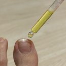 엄지문구 | 엄지발톱무좀 홈케어 닥터스유 무좀앰플 15일 사용 후기｜100% 환불 보장 제품 솔직 리뷰