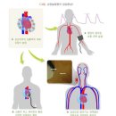 [간편]5대 심장질환 진단비(1년50%) 특별약관 이미지