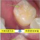 더바른 치과기공소 이미지