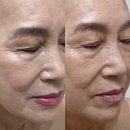 H-015 | 검단 피부관리 셀포랩 라라뷰티 (브로우살롱H) 잔주름 펴주는 크레이지015 고주파리프팅 후기