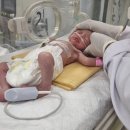 가자 공습에 숨진 엄마 뱃속 아기…제왕절개로 ‘1.4kg 생명’ 극적 생존 이미지