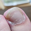 네일큐 | 큐라이드 문제성발톱앰플 솔직 후기, 젤네일로 약해진 손톱까지
