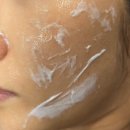 삼성밴스의원 | 삼성피부관리 콜라스터 스킨부스터효과 비포애프터