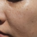 포엘메디 이미지