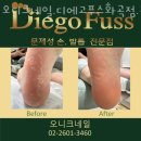 오니크네일 이미지