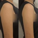 1318. 길음역 3번 출구 뒤 | w.26 : 군자신부관리/아테나뷰티에스테틱에서 상체,팔뚝 집중케어 받은 후기(가격정보)