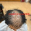 르네시떼 이미지