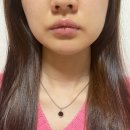 하울라스틱 | 대구 동구 하울라스틱 코랄색 입술시술 후기 1편