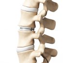 허리편한의원 이미지