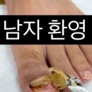 내성발톱발톱무좀관리김수정뷰티 이미지