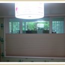 더글라스아이 이미지