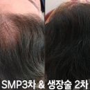 시크릿디자인 이미지