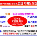 CI보험이란-중대한에 대한 조건 포함 이미지