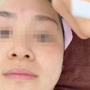 온퓨어에스테틱