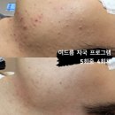 반스스킨케어