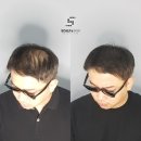 김용철산부인과의원 | 수원두피커버후기/완벽한 탈모 솔루션 /탈모커버잘하는곳!!