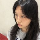 【피부과】 쥬베룩볼륨 2차 후기 (쥬베룩 부작용, 결절)