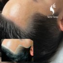 김헤어라인 이미지