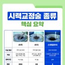 스마일 카 닥터 | 서면스마일라식 부산스마일프로 가격 정보(2025년)