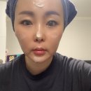 인셀덤 일산 | 일산 내돈내산 인셀덤 구입후기
