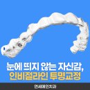미래디지털교정치과기공소 | [평촌학원가 인비절라인 치과] 투명교정의 모든 것(장단점,기간 등)