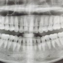 스마일100치과의원 이미지