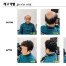 재구가발 네이버블로그