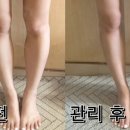 디.크라이오뷰티 이미지