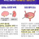 자다가 소변 야간 잦은 소변 마렵다면 이미지