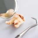 압구정스마일치과의원 이미지