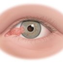 하나서울안과의원 이미지