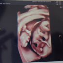 이대도치 | 임신일기 #3 - 쌍둥이 임신 24주, 그동안 했던 검사 정리 + 대학병원 전원 결정.