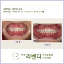 여의도 교정치과 연세라벤더치과 12월 어린이교정 후기