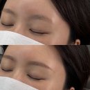 키닛브로우바 | 대구눈썹정리 | 키닛브로우바 | 비대칭 눈썹 완벽 교정(부원장님예약후기)