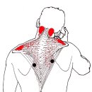 Shoulder Girdle and Rotator Cuff pain is extremely common and myofascial dysfunction is a common cause. Over 20 muscles refer pain to the shoulder and 이미지