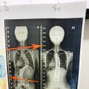 더올바로척추체형운동센터 이미지