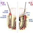 10. ﻿당뇨병의 진단과 치료방법/당뇨, 보건 최대의 적/커피와 홍차, 성인 당뇨병 막아/잇몸병 놔뒀다가 당뇨병 키울수도 이미지