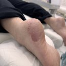 레푸스&아트포레 이미지