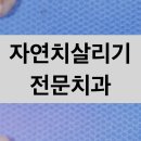 현대PLUS치과의원 | 화천치과 발치가 두렵다면 이치료부터 고민해보세요.