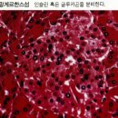 이자pancreas 다른이름 췌장 (膵臟) 이미지