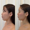 어울림빌 | 서산웨딩관리[루아뷰티]서산피부관리, 체형관리, 피부 기기관리/웨이브핏관리