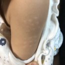 주효섭소아청소년과의원 네이버블로그
