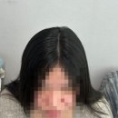 태중로 | 경기광주 정수리 탈모 관리 두피 가르마 커버 다다쁨