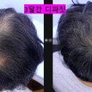 모멘텀헤어라인의원 이미지