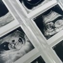 채움산부인과의원 이미지