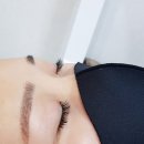 서정희피부미소