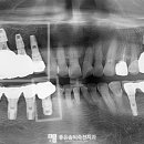 좋은솜씨죽전치과의원 이미지