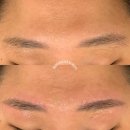 미우아카데미라인 | 왁싱하면 좋은 점은? 레이저 제모보다 왁싱을 선택하는 이유_마산왁싱_창원왁싱_미우아카데미라인