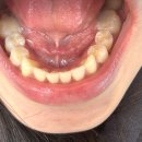 서울윌치과 이미지