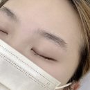 레빗브로우 이미지